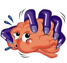 Intracranial-Hemmorhage