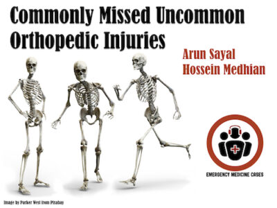 Commonly Missed Uncommon Orthopedic Injuries