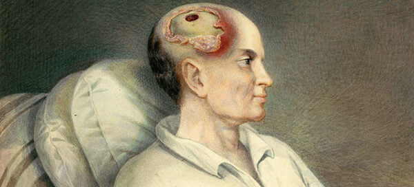 pediatric head injury