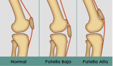 knee injuries pearls and pitfalls