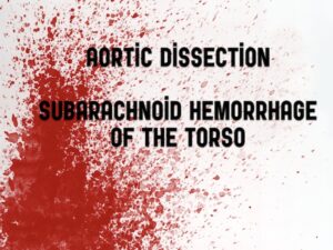 aortic dissetion live at the em cases course