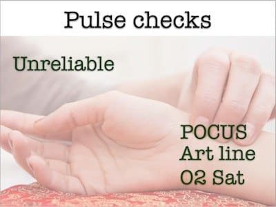 pulse checks beyond acls