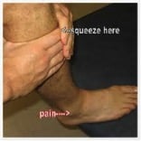 commonly missed ankle injuries