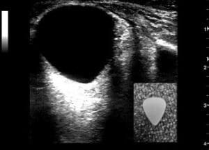 Blunt Ocular Trauma | EM Cases Course Live Podcast