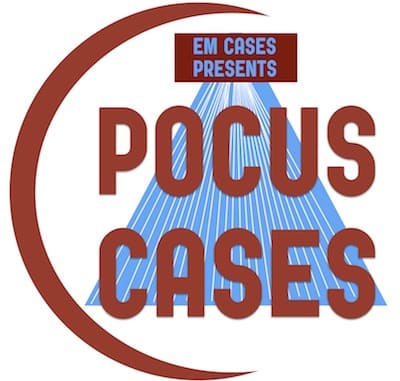 POCUS Cases 3: LV Systolic Dysfunction 