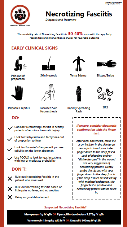 necrotizing fasciitis infographic