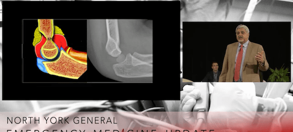 Pediatric Elbow Nightmares