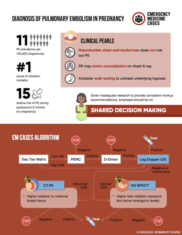 Pulmonary Embolism Workup in Pregnancy EM Cases Best