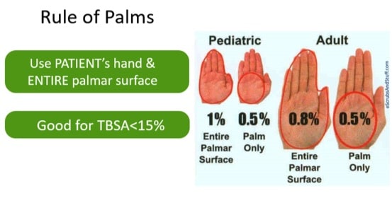 burn and inhalation injuries