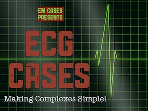 ECG Cases - Making Complexes Simple