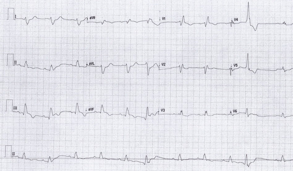 EM Cases | ECG Cases 19: tachycardias