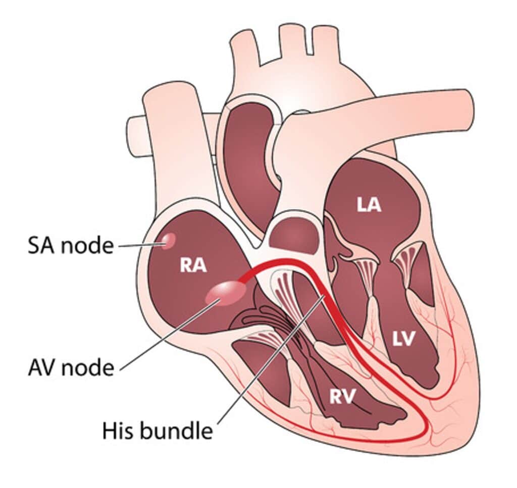 4Step Approach to Bradycardia and Bradydysrhythmias EM Cases