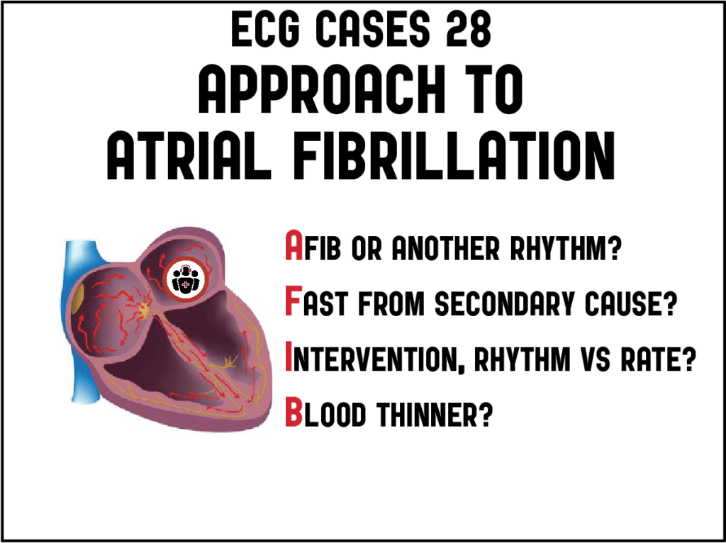 Emergency Medicine Cases | EM Cases