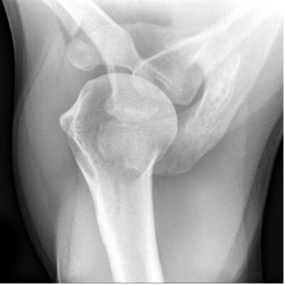 Orthopedic X rays Masterclass Emergency Medicine Cases