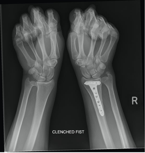 Orthopedic Xrays Masterclass Emergency Medicine Cases