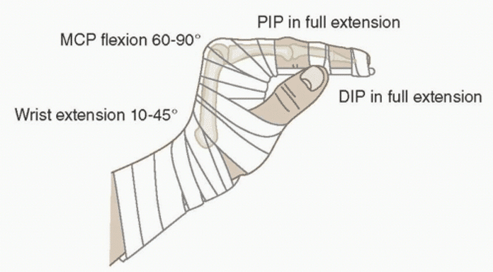 Hand Injuries - Pitfalls in Assessment | Emergency Medicine Cases