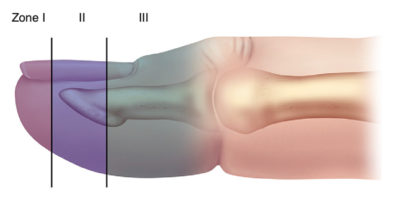 finger tip injury classification