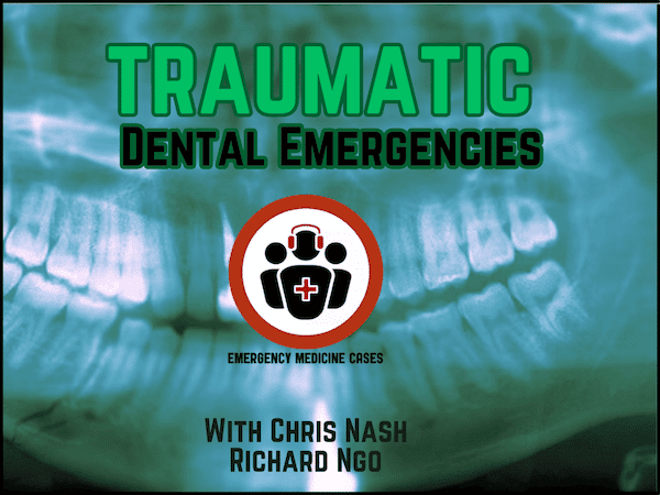 traumatic dental emergencies