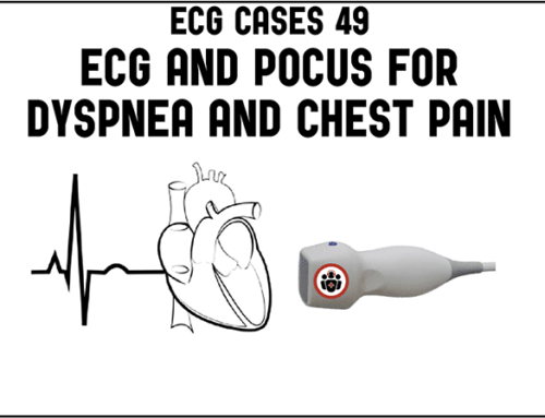 ECG Cases 49 – ECG and POCUS for Dyspnea and Chest Pain