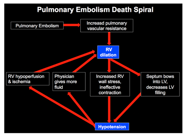 Death Spiral Pulmonary Embolism