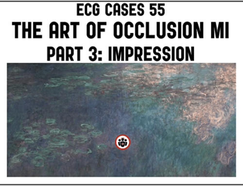 ECG Cases 55 The Art of Occlusion MI Part 3 – Impression