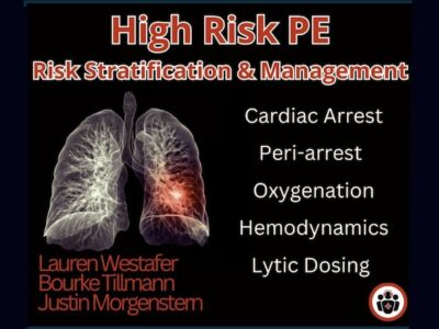 High Risk Pulmonary Embolism Management | Emergency Medicine Cases