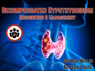 Decompensated Hypothyroidism Recognition and Management