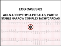 ACLS arrhythmia pitfalls, part 5: Stable Narrow Complex Tachycardia