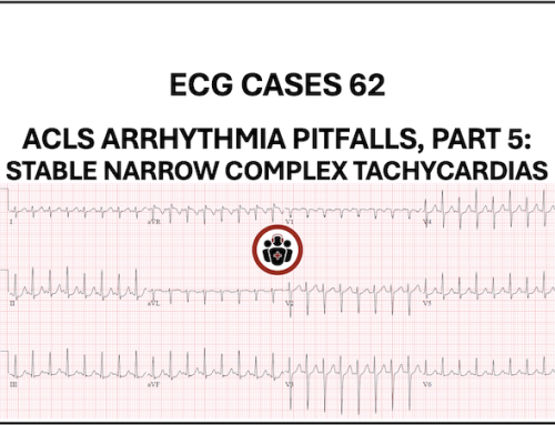 ECG Cases 62 – ACLS Arrhythmia Pitfalls, Part 5: Stable Narrow Complex Tachycardias