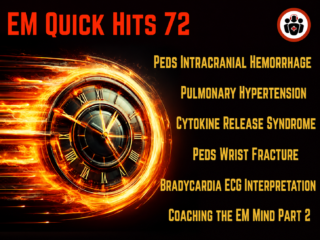 EM Quick Hits 72