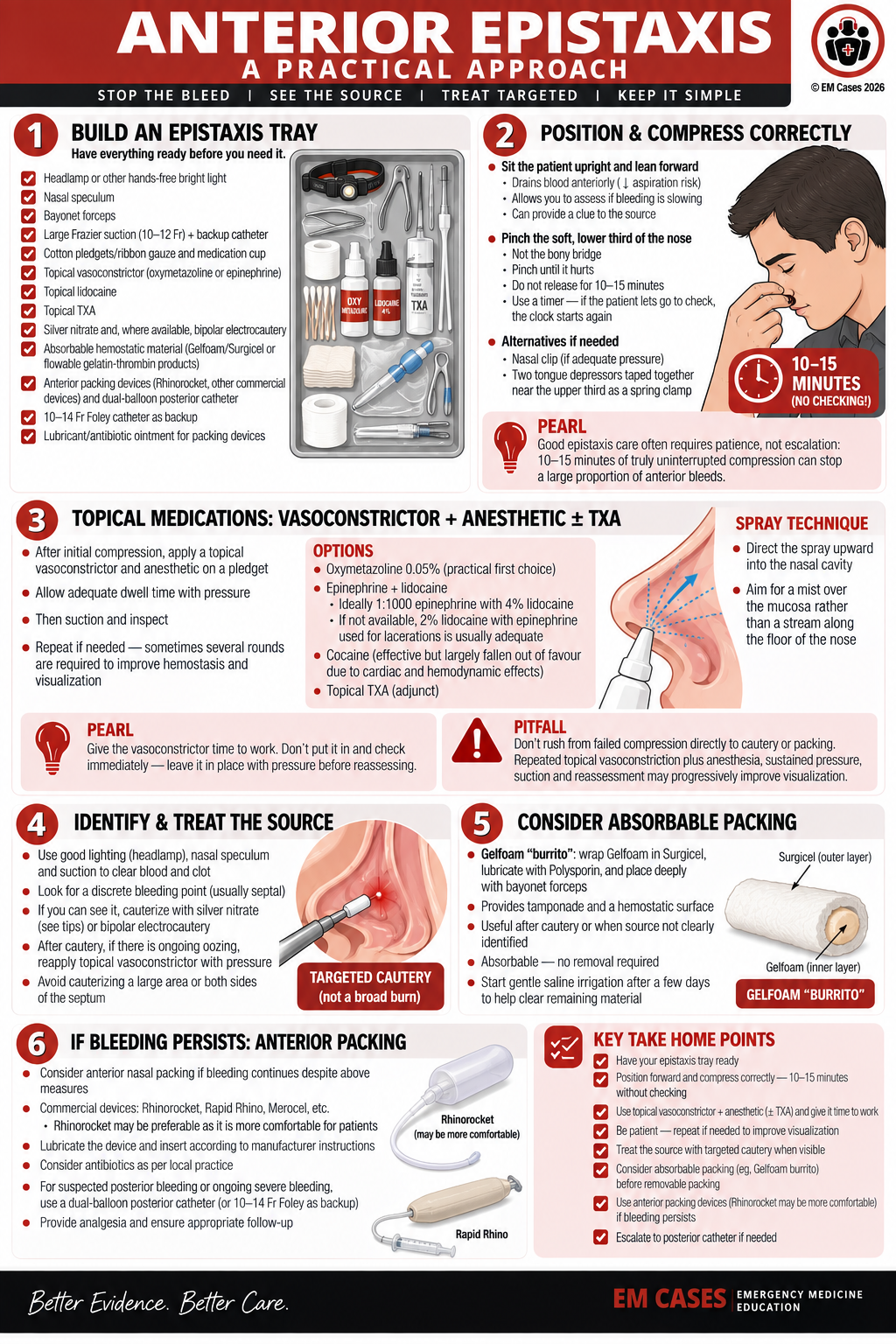 Detailed Anterior Epistaxis Management EM Cases